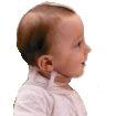 collarin cervical eos