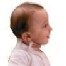 collarin cervical eos