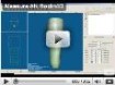 software Rodin 4d con una protesis femoral