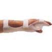 foto de ortesis postural de mano