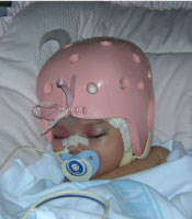 baby with a pink helmet in the hospital