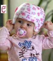 niño con un casco craneal corrector